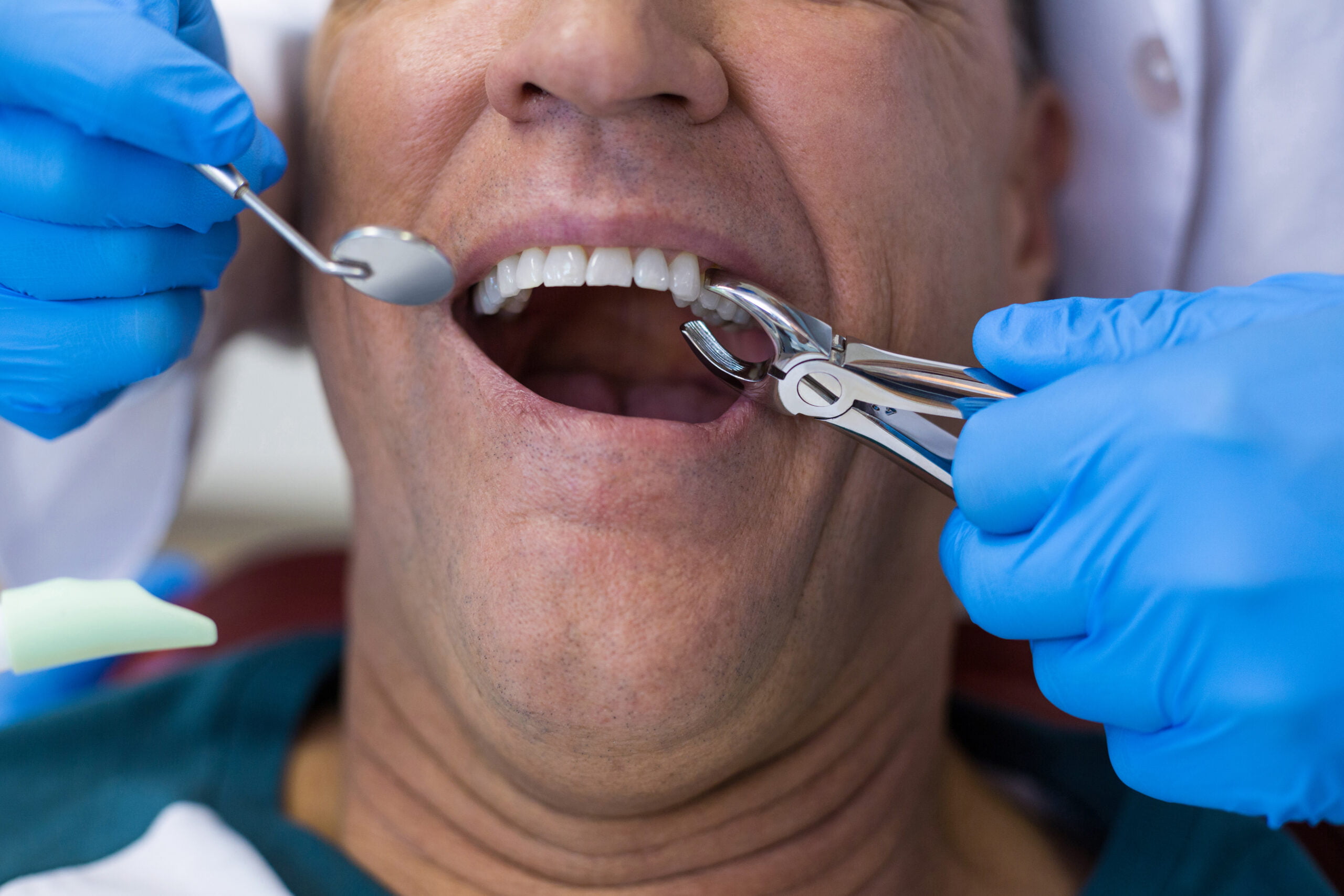 dentist using surgical pliers to remove a decaying 2023 11 27 04 50 12 utc scaled