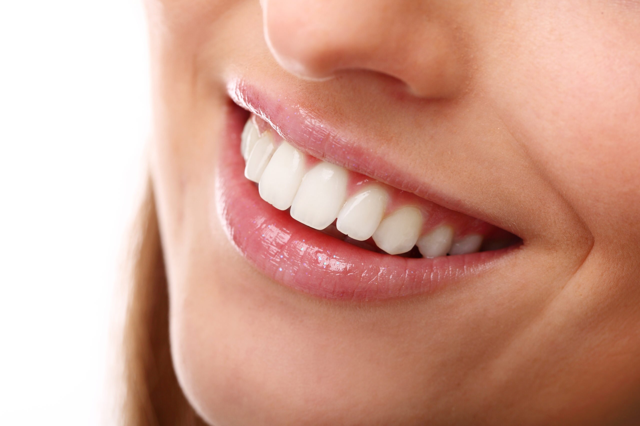 perfect smile with white teeth closeup scaled