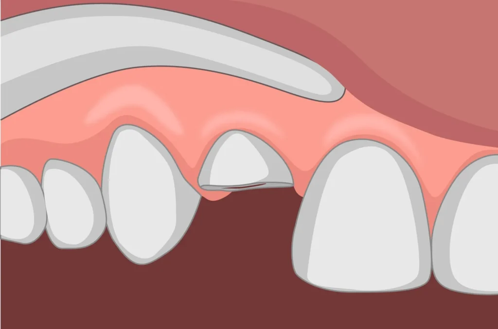 what is dental trauma alam impian